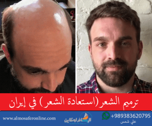 ترميم الشعر(استعادة الشعر) في إيران