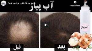 علاج لا يصدق لتساقط الشعر مع البصل