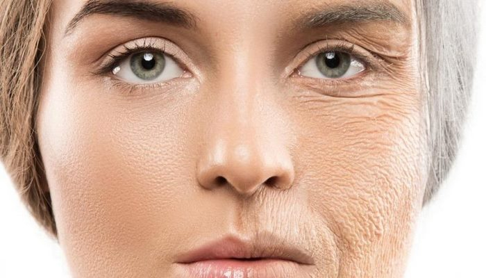أسباب وطرق علاج تجاعيد بشرة الوجه في إيران