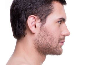 جراحة تجميل أنف الرجال في إيران
