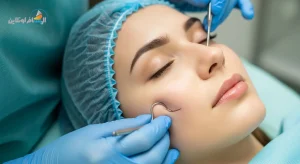 عملية إزالة دهون الخدود (Buccal Fat Removal) في إيران