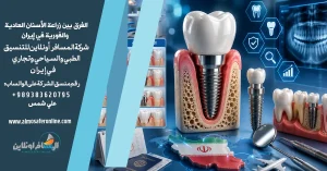 الفرق بين زراعة الأسنان العادية والفورية في إيران