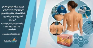 عملية شفط دهون الظهر في إيران للنساء والرجال