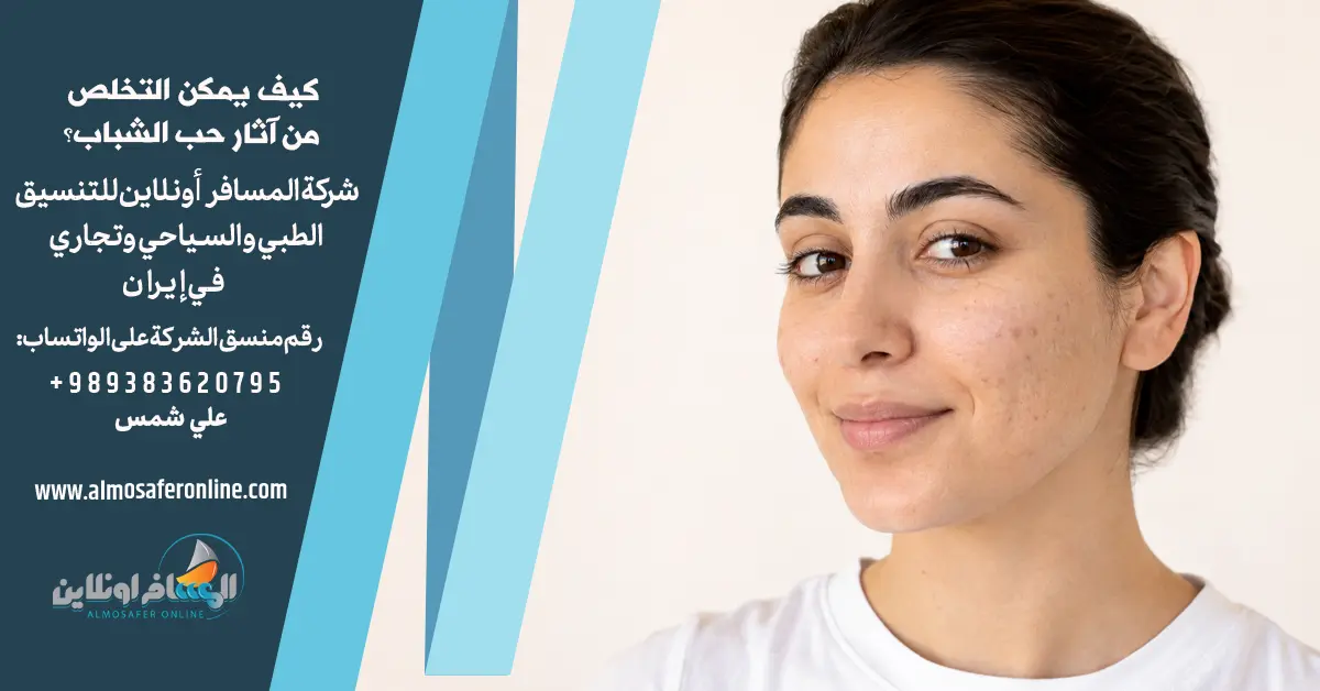 كيف يمكن التخلص من آثار حب الشباب؟