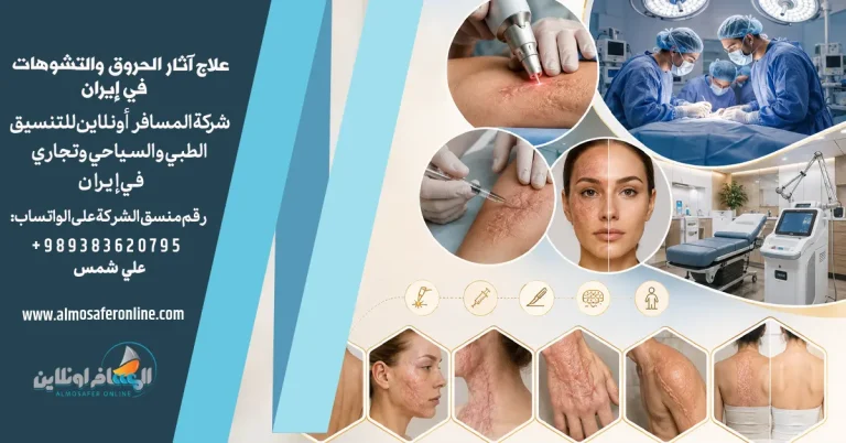 علاج آثار الحروق والتشوهات في إيران