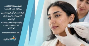 كيف يمكن التخلص من آثار حب الشباب؟