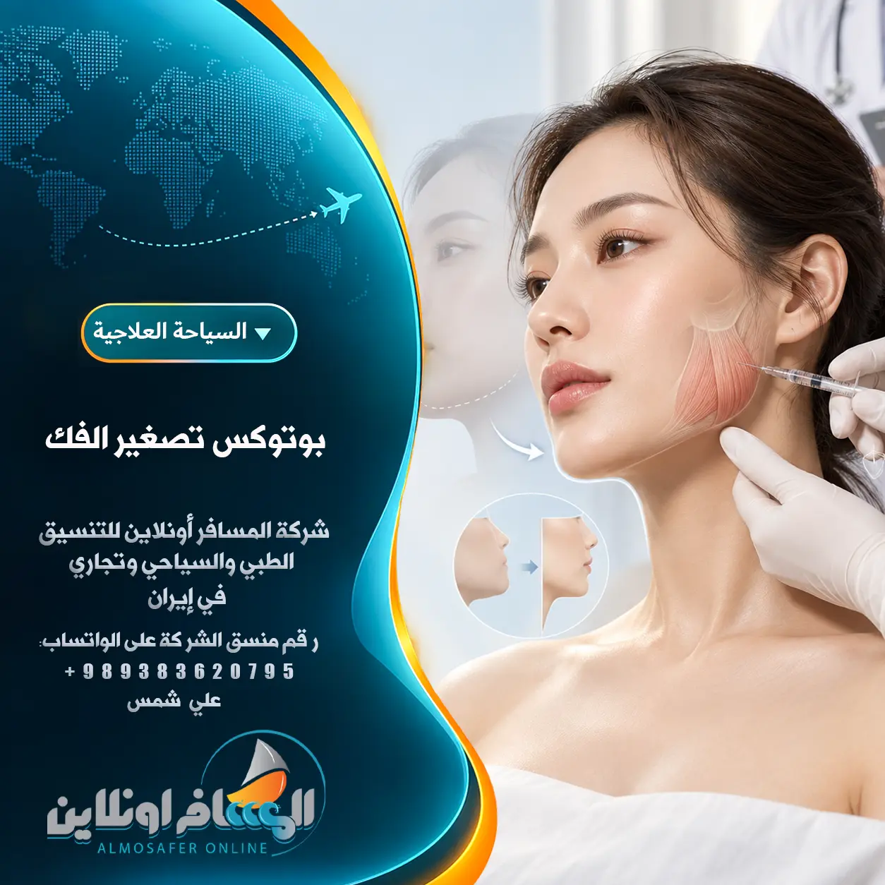 بوتوكس تصغير الفك